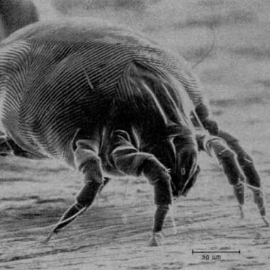 Dust Mites from a Poor HVAC Filtration System.